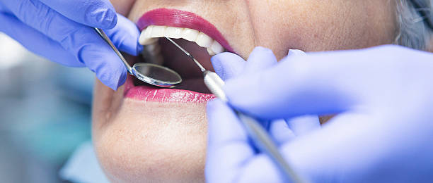 Best Emergency Dental Care for Broken or Chipped Teeth in Upper Fruitland, NM